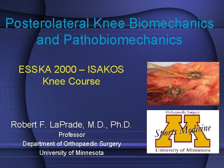 Posterolateral Knee Biomechanics and Pathobiomechanics ESSKA 2000 – ISAKOS Knee Course Robert F. La.