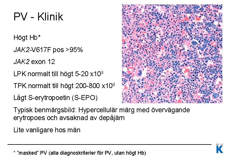 PV - Klinik Högt Hb* JAK 2 -V 617 F pos >95% JAK 2