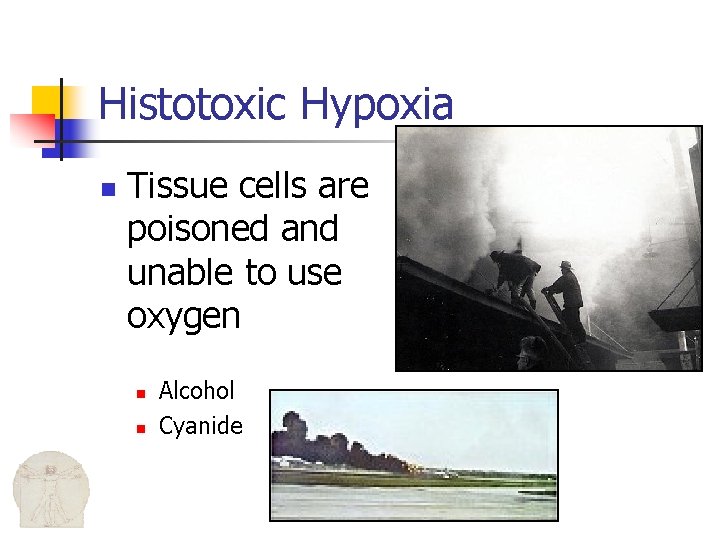 Histotoxic Hypoxia n Tissue cells are poisoned and unable to use oxygen n n