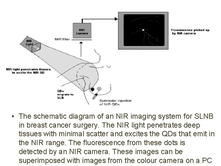  • The schematic diagram of an NIR imaging system for SLNB in breast