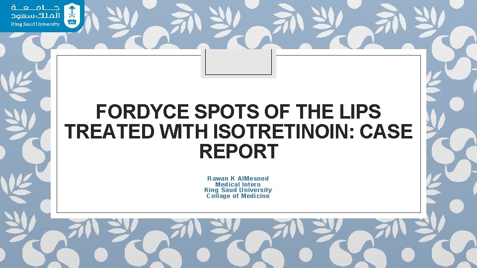 FORDYCE SPOTS OF THE LIPS TREATED WITH ISOTRETINOIN: CASE REPORT Rawan K Al. Mesned