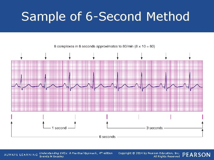 Sample of 6 -Second Method Understanding EKGs: A Practical Approach, 4 th edition Brenda