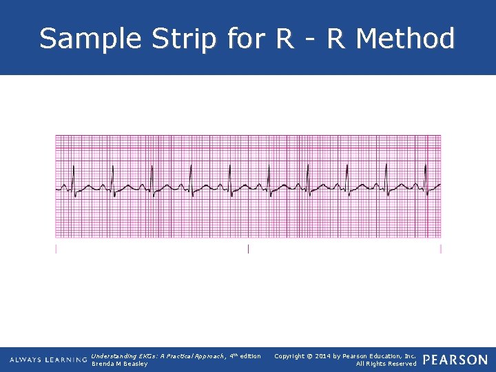 Sample Strip for R - R Method Understanding EKGs: A Practical Approach, 4 th