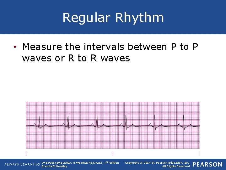 Regular Rhythm • Measure the intervals between P to P waves or R to