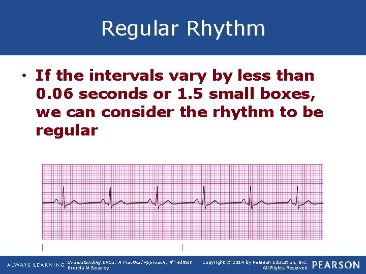 Regular Rhythm • If the intervals vary by less than 0. 06 seconds or