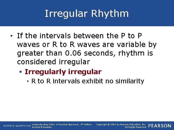 Irregular Rhythm • If the intervals between the P to P waves or R