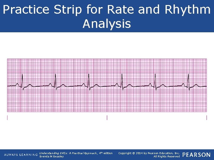Practice Strip for Rate and Rhythm Analysis Understanding EKGs: A Practical Approach, 4 th