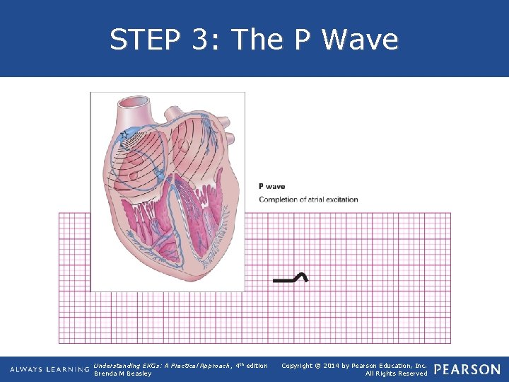 STEP 3: The P Wave Understanding EKGs: A Practical Approach, 4 th edition Brenda