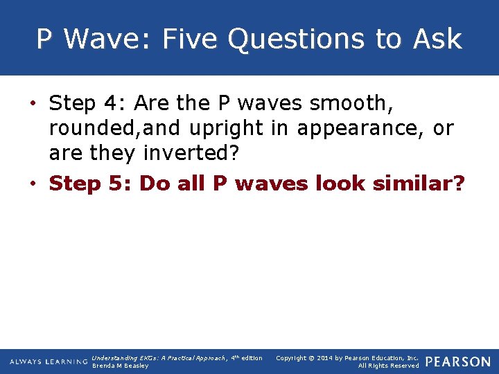P Wave: Five Questions to Ask • Step 4: Are the P waves smooth,