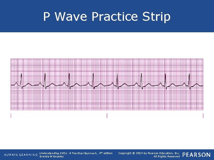 P Wave Practice Strip Understanding EKGs: A Practical Approach, 4 th edition Brenda M