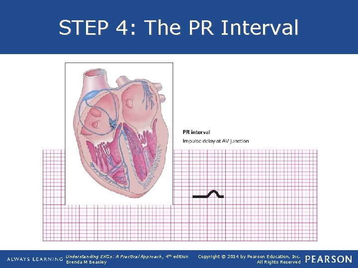 STEP 4: The PR Interval Understanding EKGs: A Practical Approach, 4 th edition Brenda