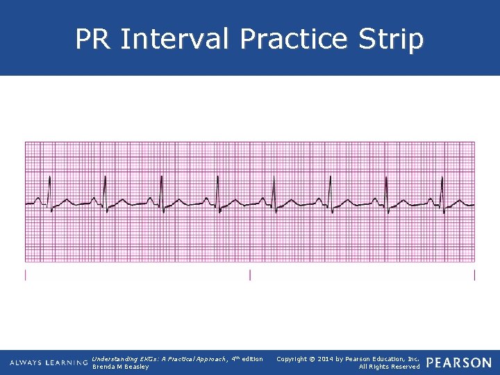 PR Interval Practice Strip Understanding EKGs: A Practical Approach, 4 th edition Brenda M