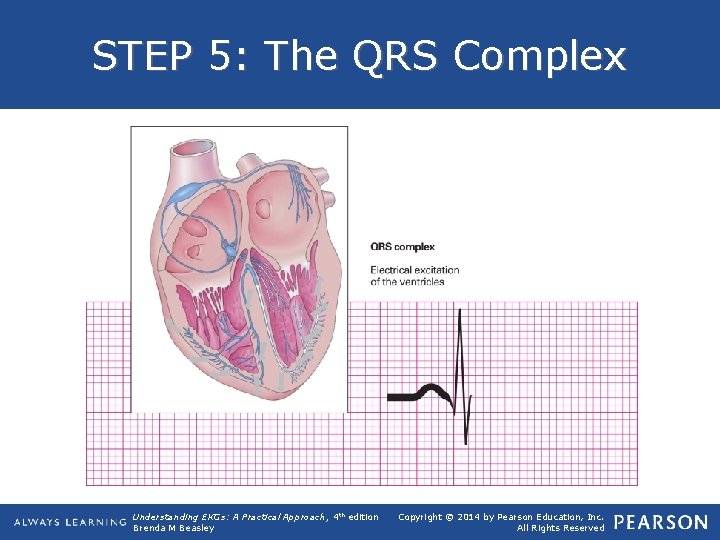 STEP 5: The QRS Complex Understanding EKGs: A Practical Approach, 4 th edition Brenda