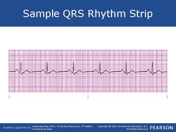 Sample QRS Rhythm Strip Understanding EKGs: A Practical Approach, 4 th edition Brenda M