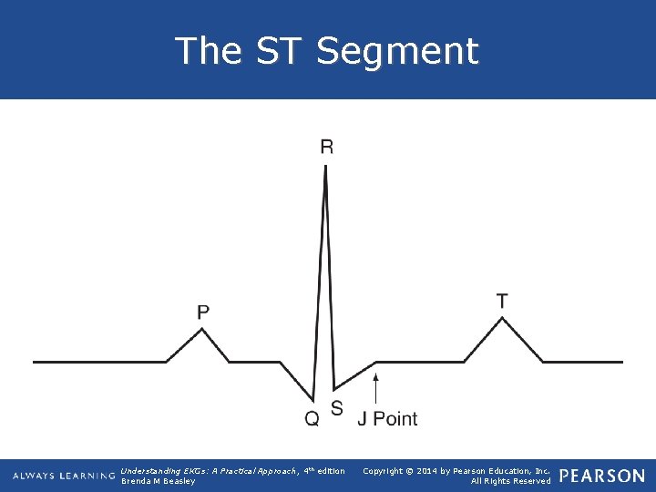 The ST Segment Understanding EKGs: A Practical Approach, 4 th edition Brenda M Beasley