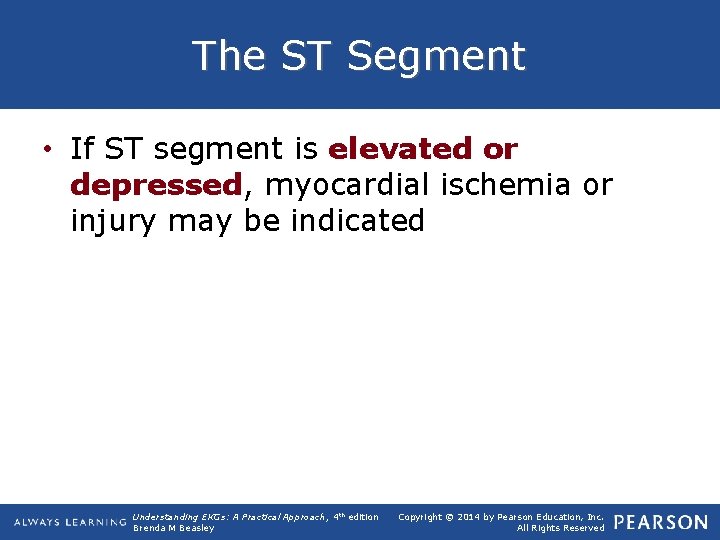 The ST Segment • If ST segment is elevated or depressed, myocardial ischemia or