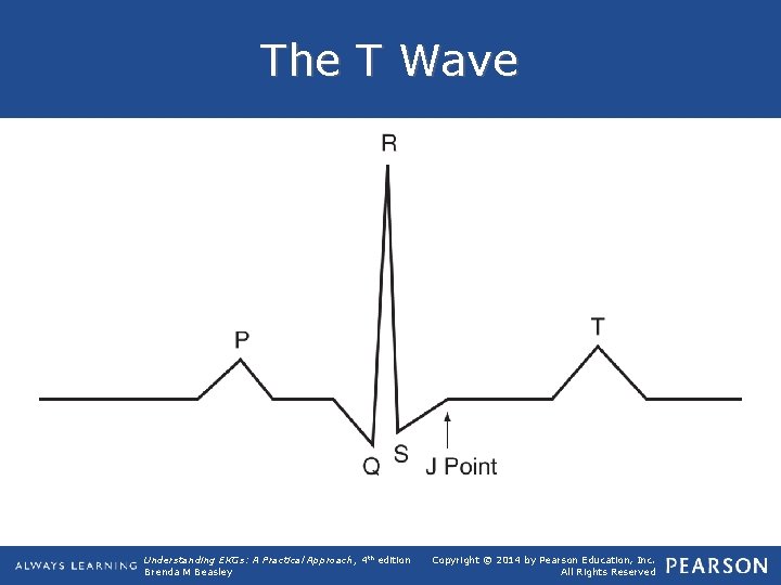 The T Wave Understanding EKGs: A Practical Approach, 4 th edition Brenda M Beasley