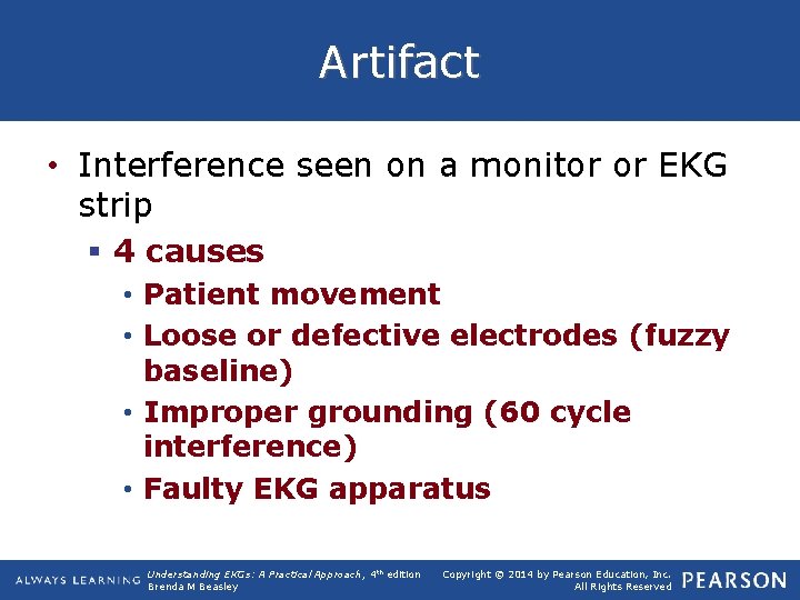 Artifact • Interference seen on a monitor or EKG strip § 4 causes •