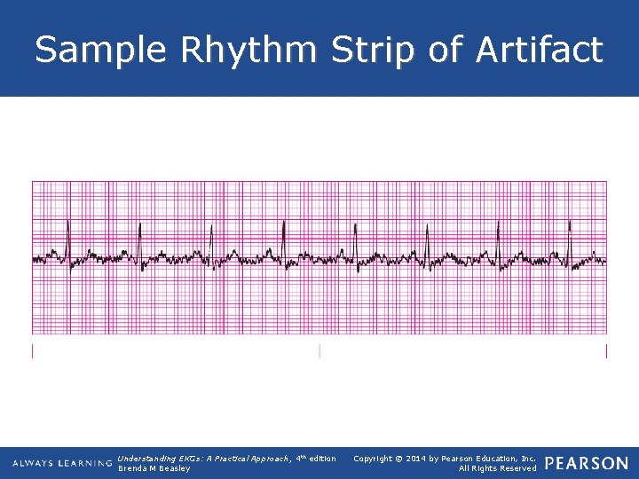 Sample Rhythm Strip of Artifact Understanding EKGs: A Practical Approach, 4 th edition Brenda