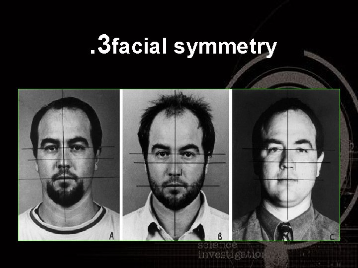 . 3 facial symmetry 