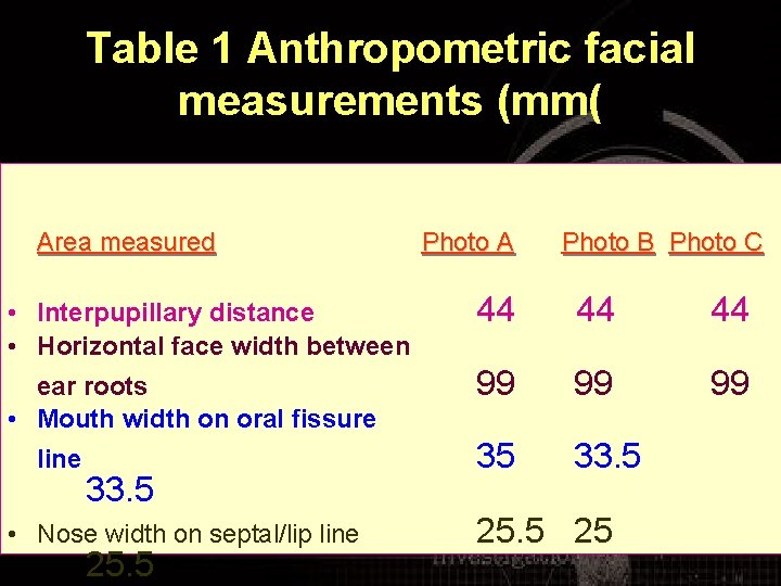 Table 1 Anthropometric facial measurements (mm( Area measured Photo A Photo B Photo C