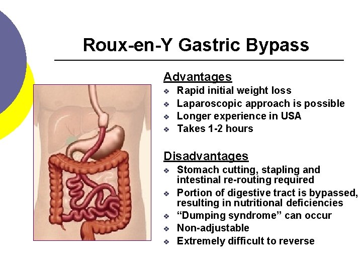 Roux-en-Y Gastric Bypass Advantages v v Rapid initial weight loss Laparoscopic approach is possible