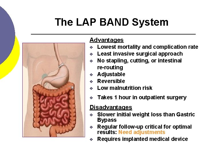 The LAP BAND System Advantages v Lowest mortality and complication rate Least invasive surgical