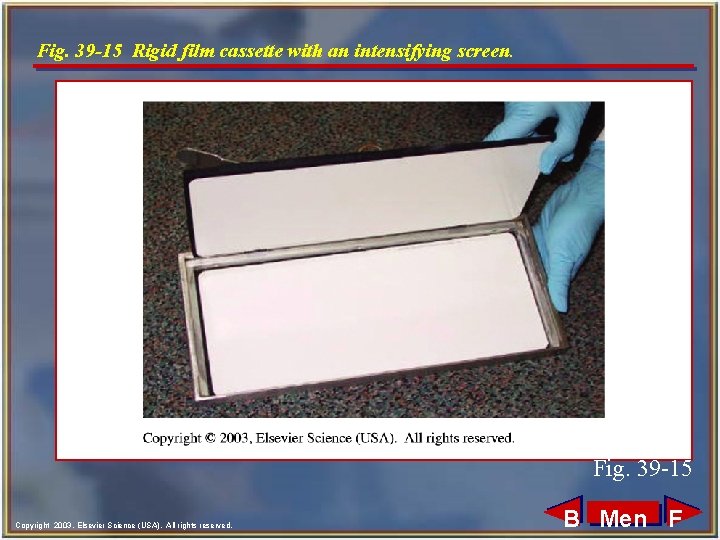 Fig. 39 -15 Rigid film cassette with an intensifying screen. Fig. 39 -15 Copyright Fig. 39 -15 Rigid film cassette with an intensifying screen. Fig. 39 -15 Copyright