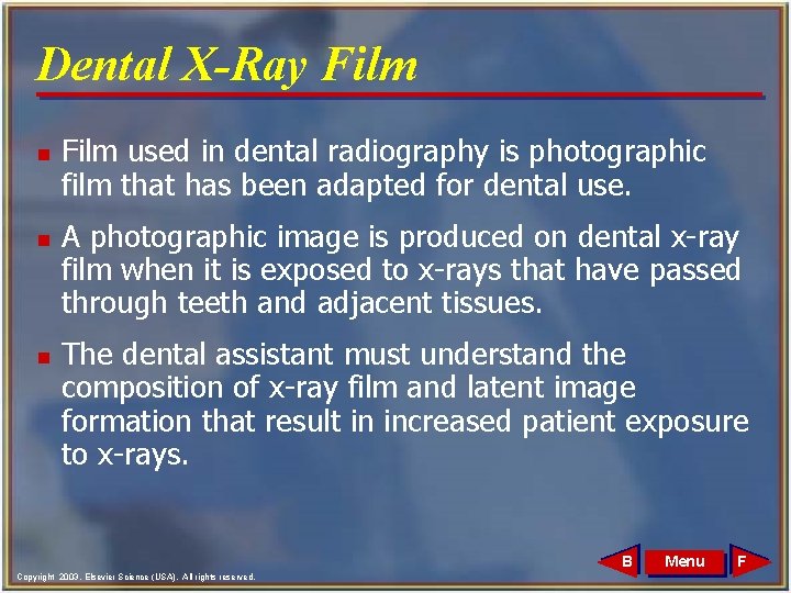 Dental X-Ray Film n n n Film used in dental radiography is photographic film Dental X-Ray Film n n n Film used in dental radiography is photographic film