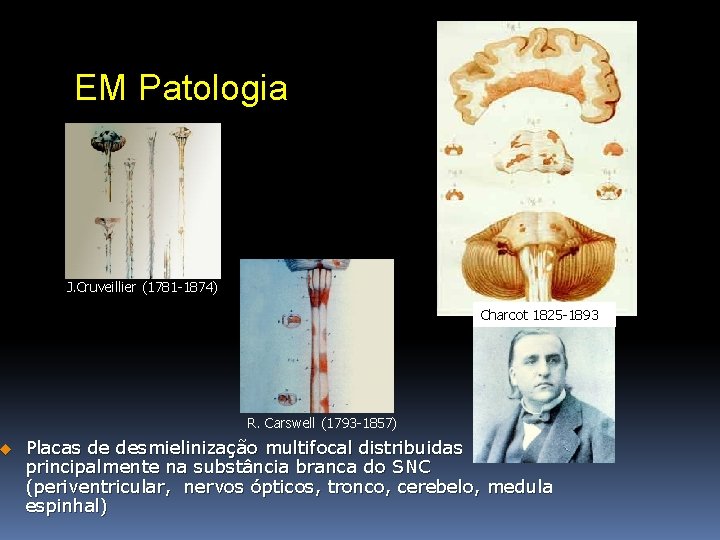 u EM Patologia J. Cruveillier (1781 -1874) Charcot 1825 -1893 R. Carswell (1793 -1857)