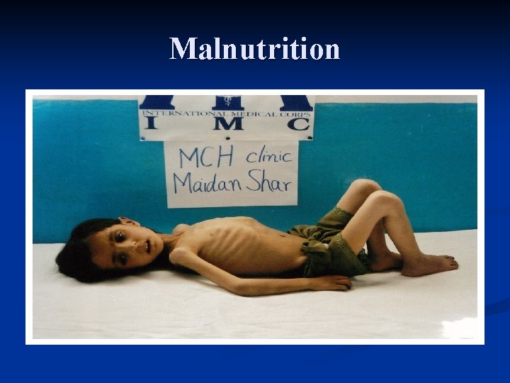 Malnutrition 