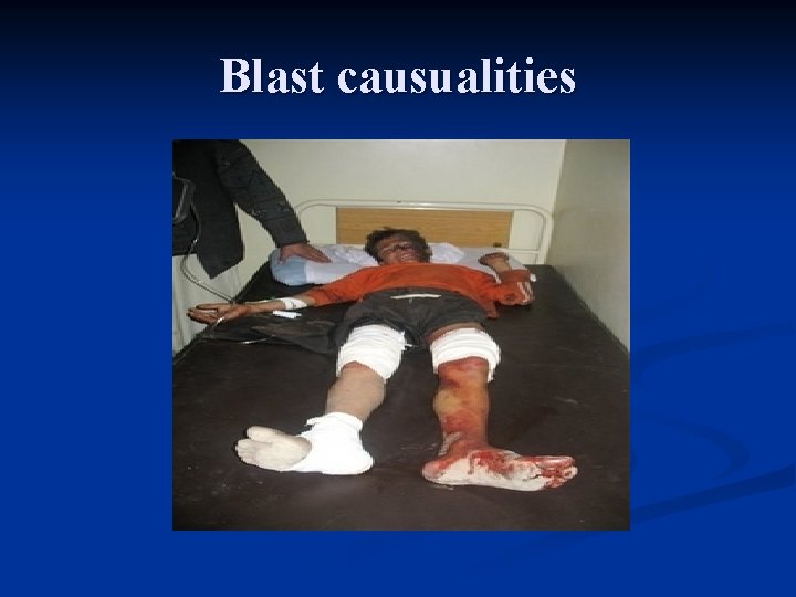 Blast causualities 