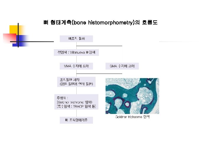 뼈 형태계측(bone histomorphometry)의 흐름도 