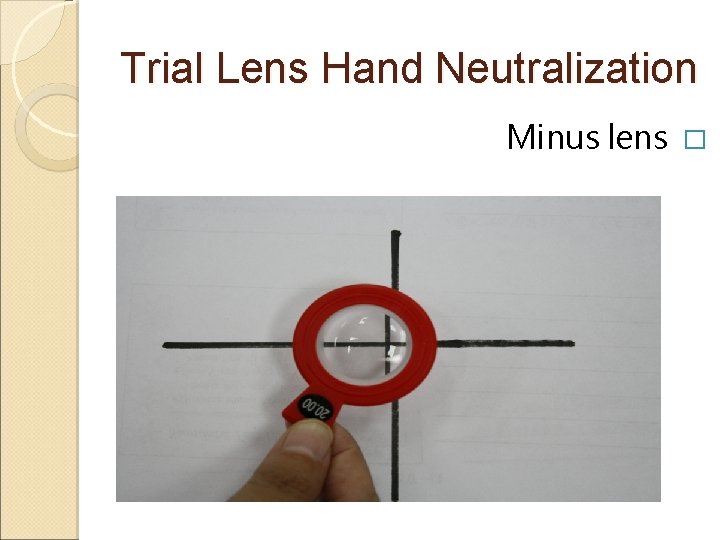 Trial Lens Hand Neutralization Minus lens � Trial Lens Hand Neutralization Minus lens �