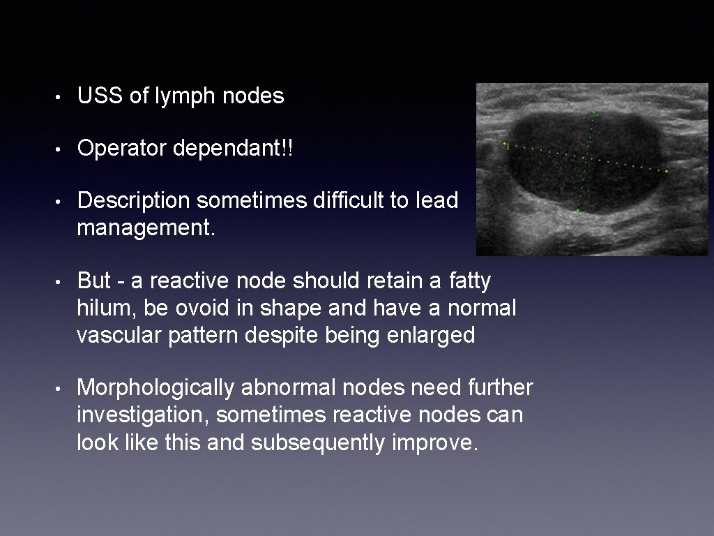  • USS of lymph nodes • Operator dependant!! • Description sometimes difficult to