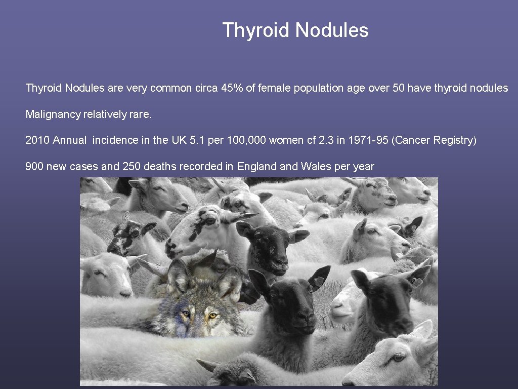 Thyroid Nodules are very common circa 45% of female population age over 50 have