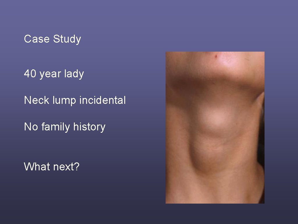 Case Study 40 year lady Neck lump incidental No family history What next? 