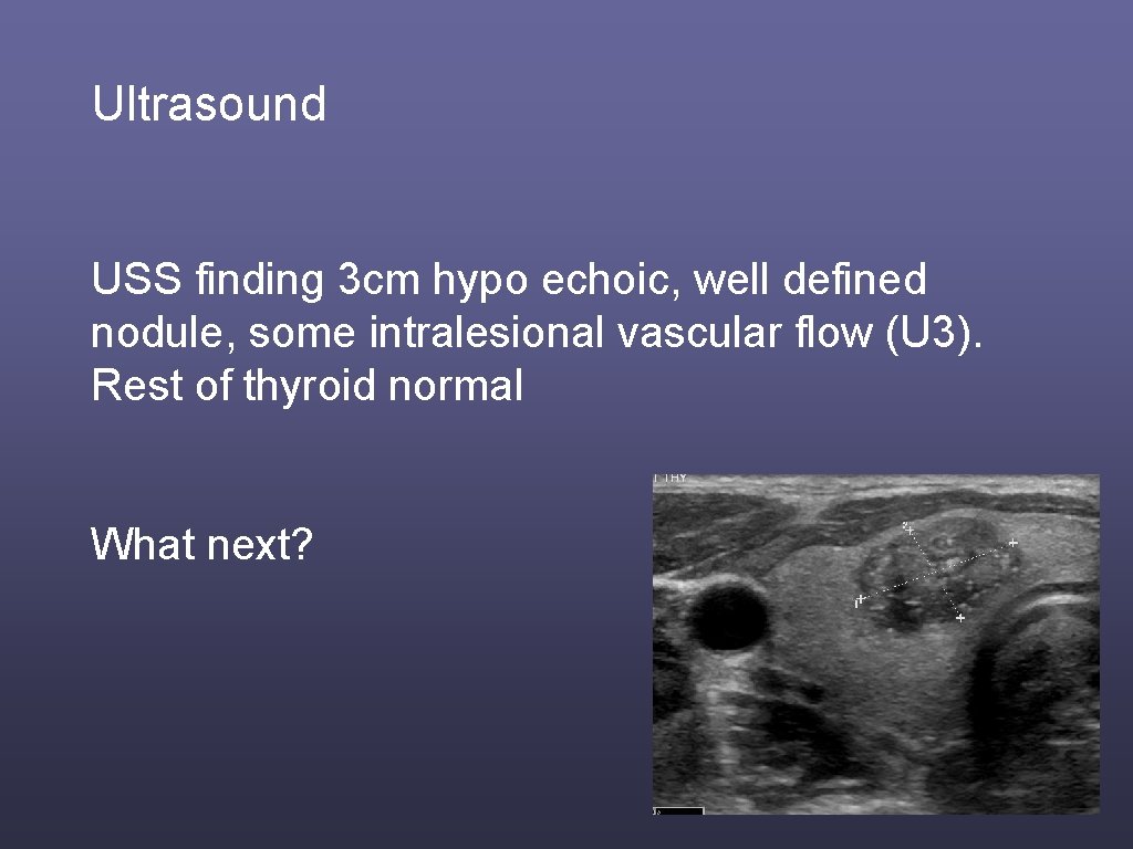 Ultrasound USS finding 3 cm hypo echoic, well defined nodule, some intralesional vascular flow