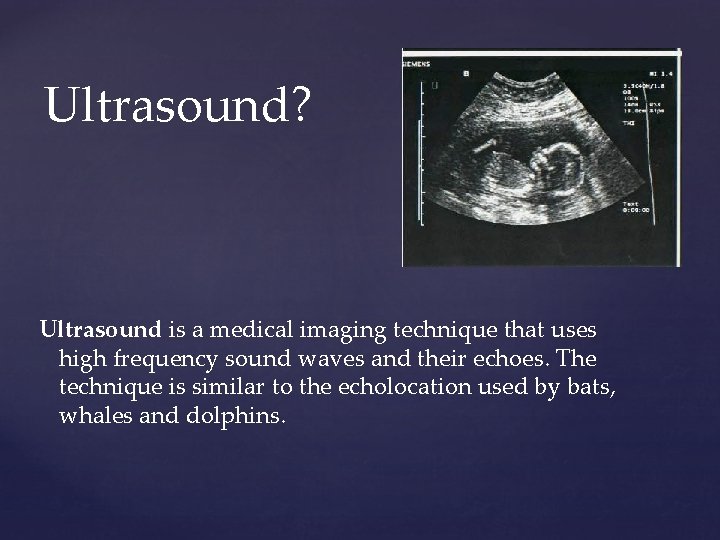 Ultrasound? Ultrasound is a medical imaging technique that uses high frequency sound waves and