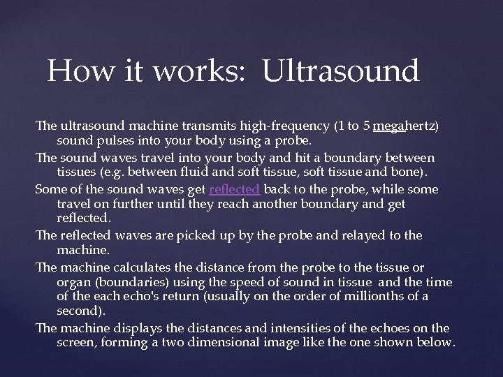 How it works: Ultrasound The ultrasound machine transmits high-frequency (1 to 5 megahertz) sound