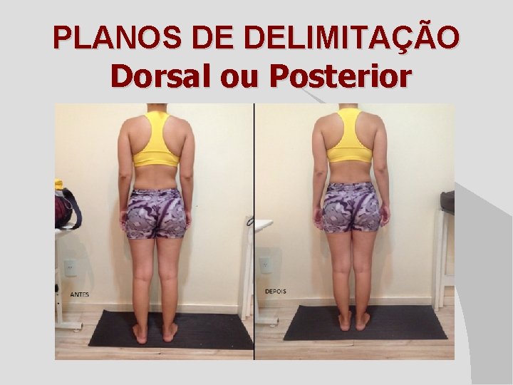 PLANOS DE DELIMITAÇÃO Dorsal ou Posterior 