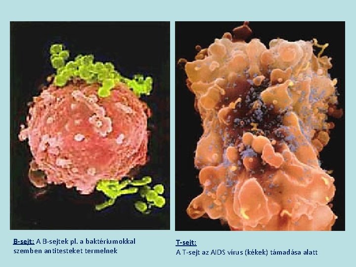 B-sejt: A B-sejtek pl. a baktériumokkal szemben antitesteket termelnek T-sejt: A T-sejt az AIDS