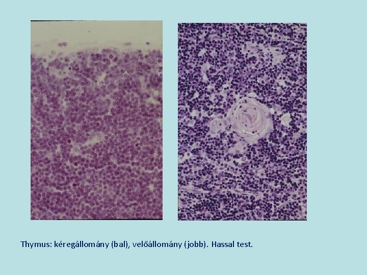 Thymus: kéregállomány (bal), velőállomány (jobb). Hassal test. 