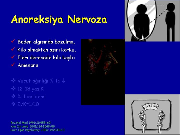 Anoreksiya Nervoza ü ü Beden algısında bozulma, Kilo almaktan aşırı korku, İleri derecede kilo Anoreksiya Nervoza ü ü Beden algısında bozulma, Kilo almaktan aşırı korku, İleri derecede kilo