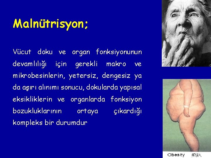Malnütrisyon; Vücut doku ve organ fonksiyonunun devamlılığı için gerekli makro ve mikrobesinlerin, yetersiz, dengesiz Malnütrisyon; Vücut doku ve organ fonksiyonunun devamlılığı için gerekli makro ve mikrobesinlerin, yetersiz, dengesiz