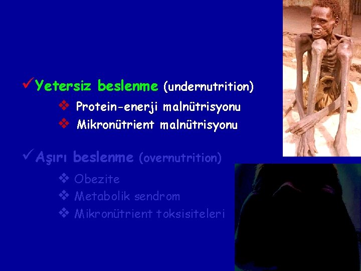 üYetersiz beslenme (undernutrition) v Protein-enerji malnütrisyonu v Mikronütrient malnütrisyonu üAşırı beslenme (overnutrition) v Obezite üYetersiz beslenme (undernutrition) v Protein-enerji malnütrisyonu v Mikronütrient malnütrisyonu üAşırı beslenme (overnutrition) v Obezite