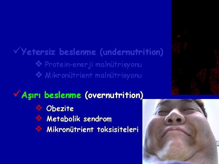 üYetersiz beslenme (undernutrition) v Protein-enerji malnütrisyonu v Mikronütrient malnütrisyonu üAşırı beslenme (overnutrition) v v üYetersiz beslenme (undernutrition) v Protein-enerji malnütrisyonu v Mikronütrient malnütrisyonu üAşırı beslenme (overnutrition) v v