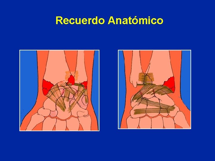 Recuerdo Anatómico Recuerdo Anatómico