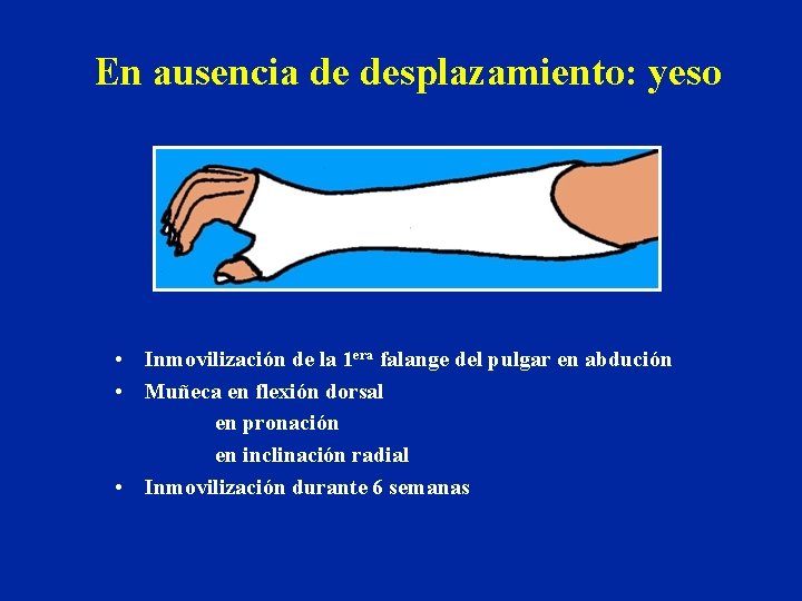 En ausencia de desplazamiento: yeso • Inmovilización de la 1 era falange del pulgar En ausencia de desplazamiento: yeso • Inmovilización de la 1 era falange del pulgar