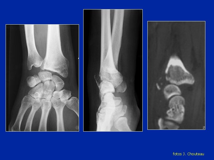 fotos J. Chouteau fotos J. Chouteau